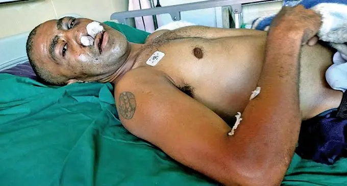 SURVIVED... Stevedore Joji Tuipolotu is being treated at the Colonial War Memorial Hospital in Suva.  