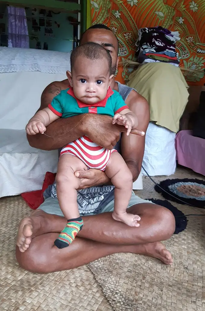 Baby Ioane Ravuama was one of the first cases of measles to be confirmed by the Ministry of Health.  Photo: Shalveen Chand
