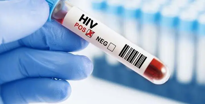 HIV crisis: ‘Enough talk, more action’