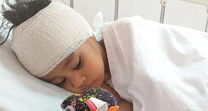 Two-year-old Amari Whippy recovering from surgery at the Lautoka Hospital. Photo: Lydia Whippy