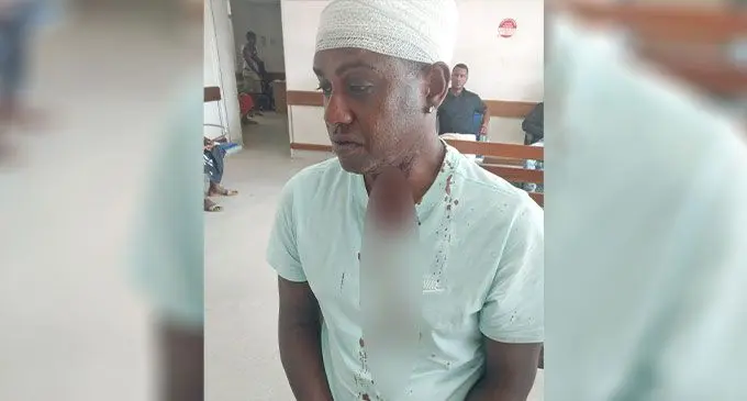 Sakhawat Ali at the Lautoka Aspen Hospital Photo: Waisea Nasokia