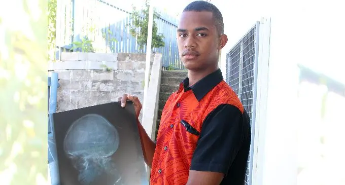 Marist Brothers High School student Savenaca Domoni holds his X-ray film results that shows the injury on his skull he suffered  during a rugby match at the Suva Grammar School grounds on June 22, 2019. Photo: Simione Haravanua