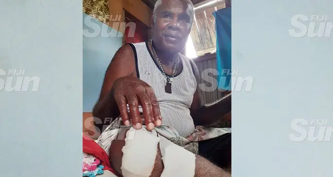 Taxi driver Veremo Vakasilimi, 61, suffered injuries to his knees, chest and face after he was allegedly kicked and punched by five youths who robbed him of his day’s income and taxi on October 29, 2019. Photos: Ronald Kumar