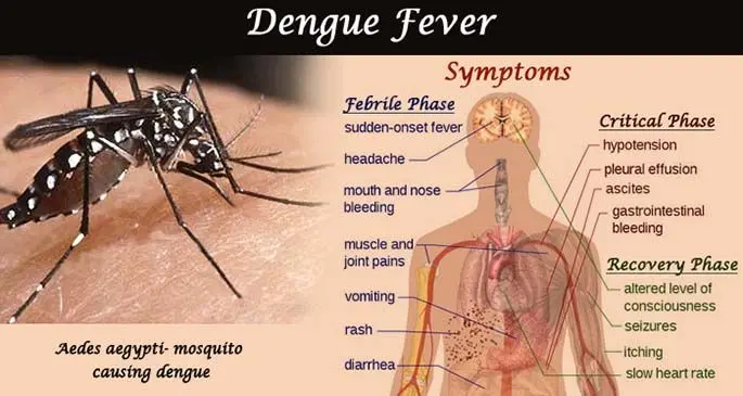 A dengue fever chart.