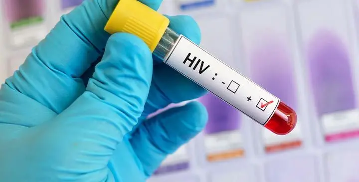 HIV-TEST