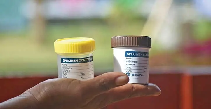 The typhoid specimen container that was given to Nasuva villagers on June 12, 2023. Photo: Jone Salusalu