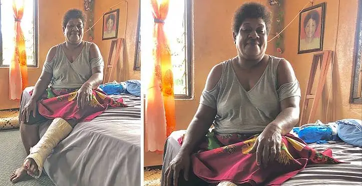 Mereseini Koroi, 49, recovering at her residence in Raralevu, Tailevu. Photo: Beranadeta Nagatalevu