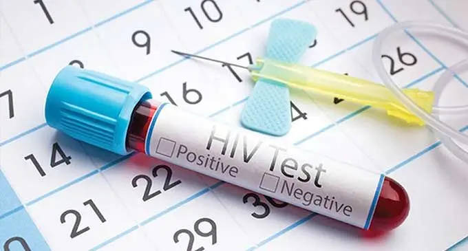 hiv-test