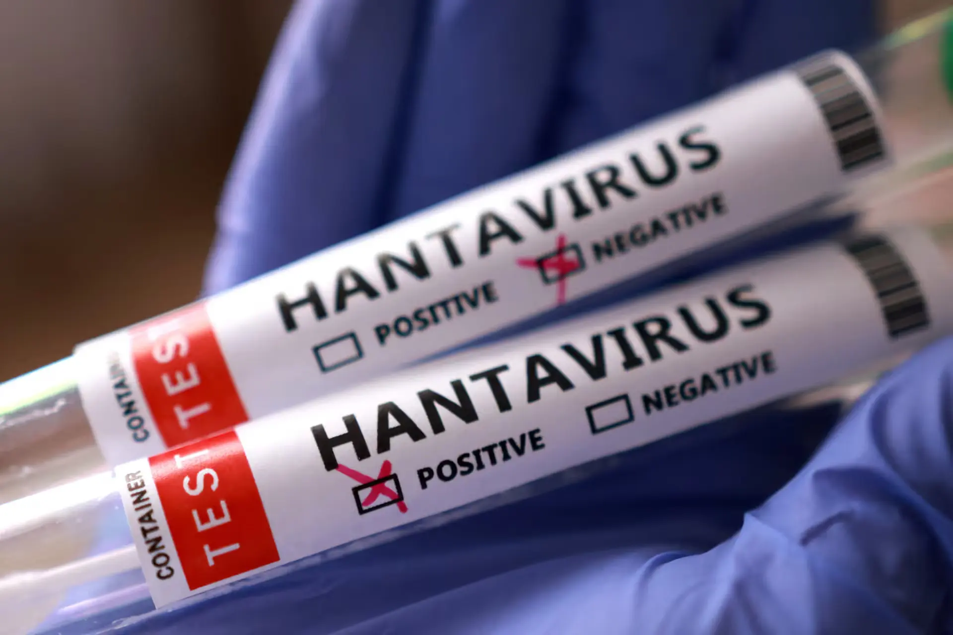 hantaviurus