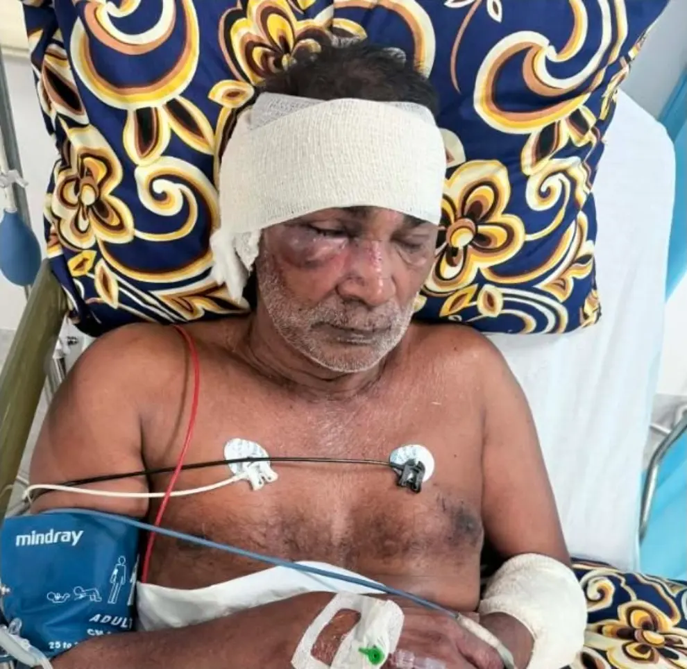 Rosan Ali remains admitted at Lautoka Hospital after he was allegedly abducted and brutally assaulted at Coral Cord Road in the Saweni Tramline Tyre Centre area on Wednesday.
