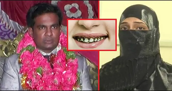 Mustafa, 36, Divorced Wife Rukhsana Begum, 27, for her Crooked Teeth after 3 Months of Marriage. Photo: MereMirpur