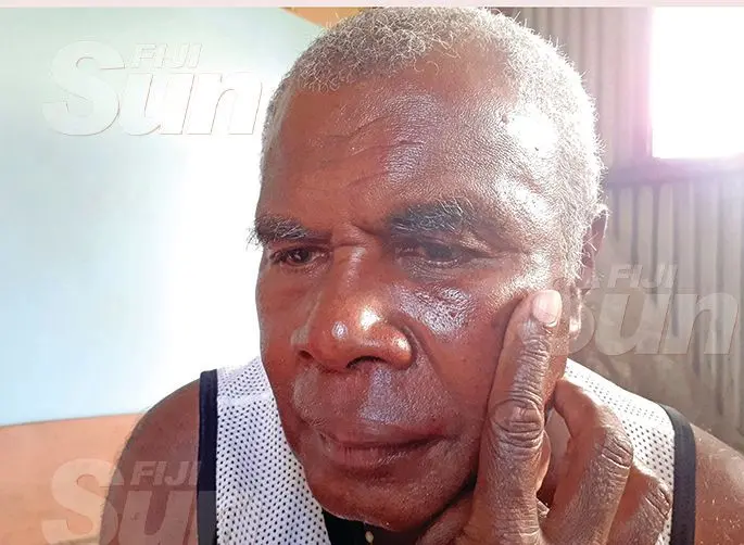 Sixty one year-old Veremo Vakasilimi shows the bruises to his face from the attack. Photo: Ronald Kumar.