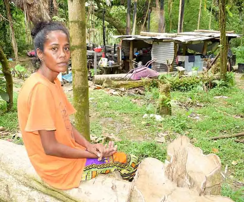 Jessie Liko shows her leaving condition after her home was burnt late last year. Photo: Ronald Kumar.