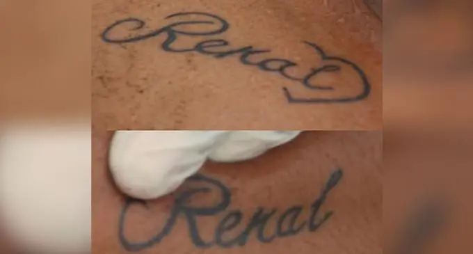The tattoos on the deceased’s body.