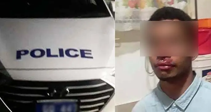The photos on the social media post claiming the alleged involvement of police officers in an alleged case of police assault.