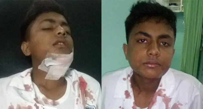 The injured Kelvin Kishal Chand.